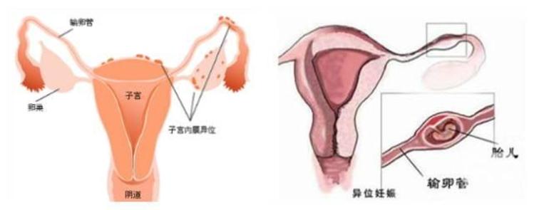 生儿子