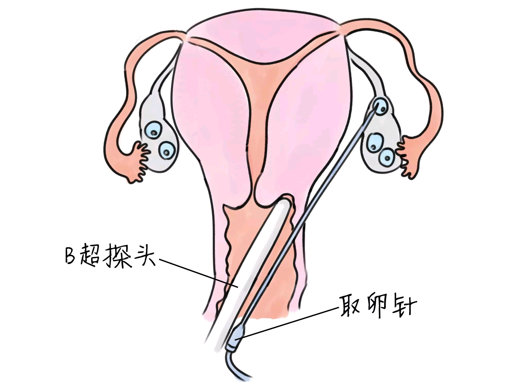 婆婆带娃