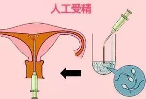 孕前检查