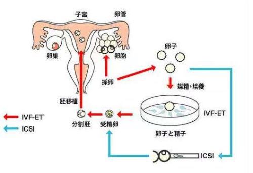 男生体验分娩