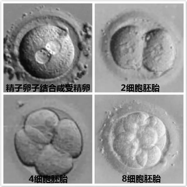 妊娠纹