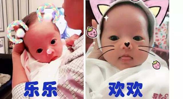 妊娠纹