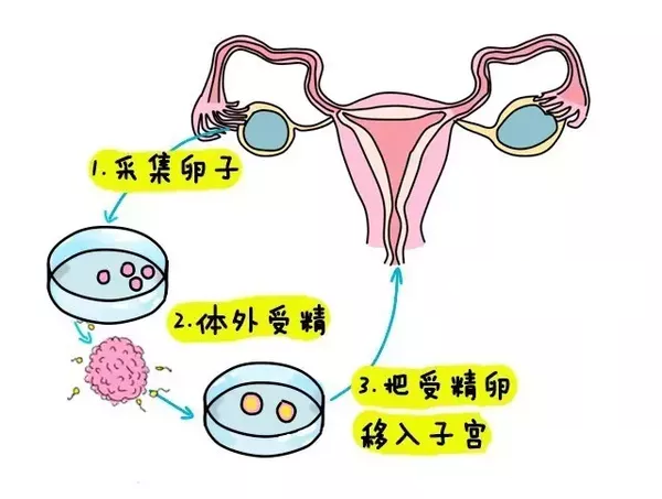 男性不孕不育