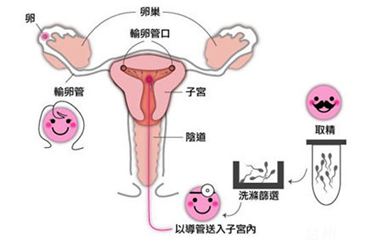 男方孕前检查