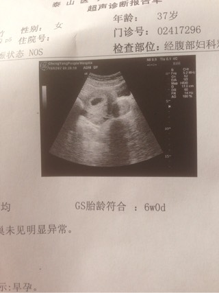 男性不育