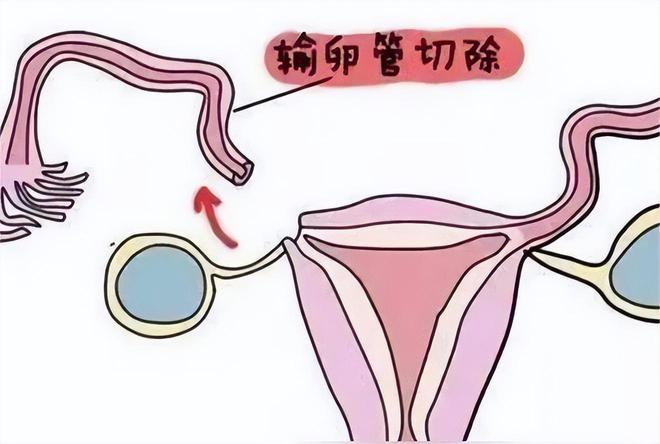 妊娠纹