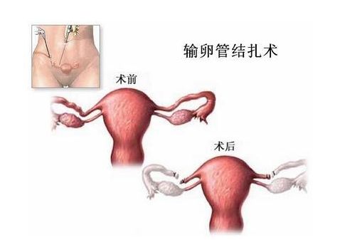 男士孕前检查
